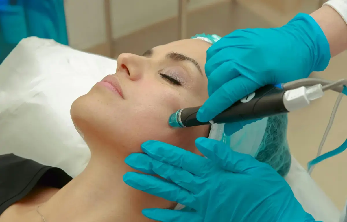 Microneedling in Las Vegas, NV That Renews Your Skin